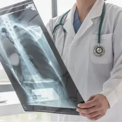 Lekarz analizuje zdjęcie rentgenowskie klatki piersiowej (thorax po polsku), oceniając stan płuc i żeber.